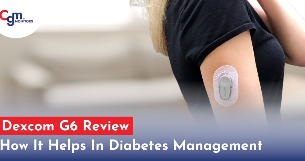 Dexcom G6 Review