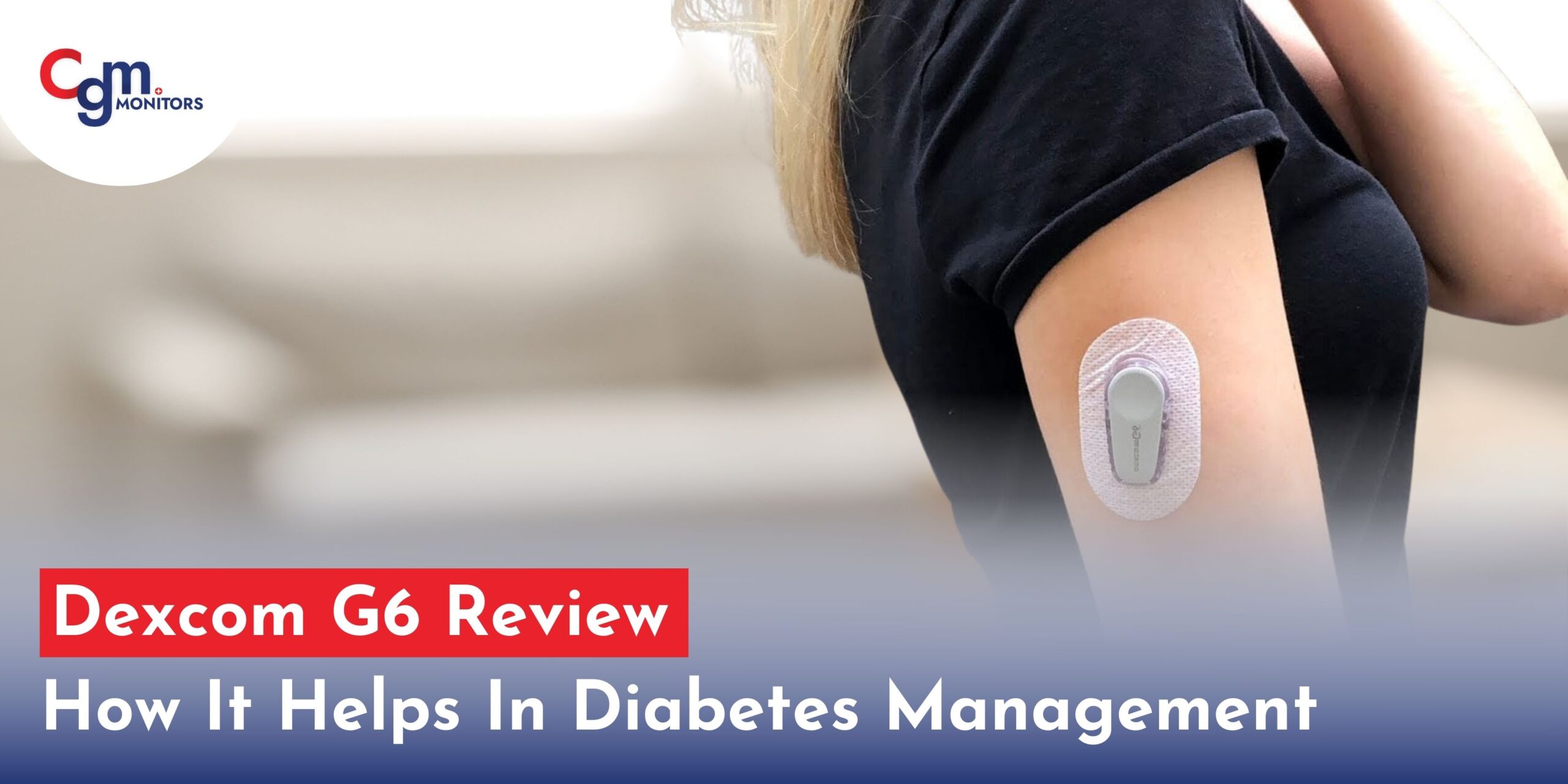 Dexcom G6 Review