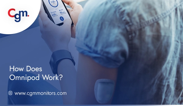 How Does Omnipod Work