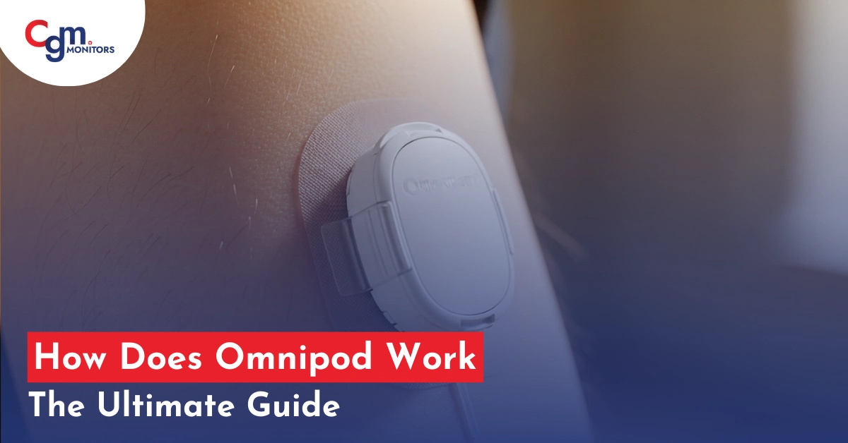 Omnipod Work