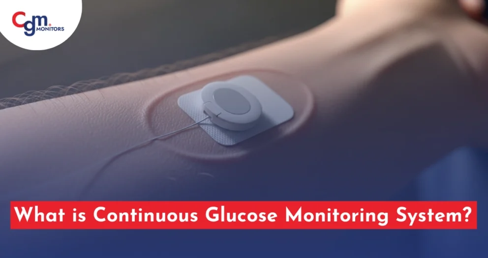Continuous Glucose Monitoring System