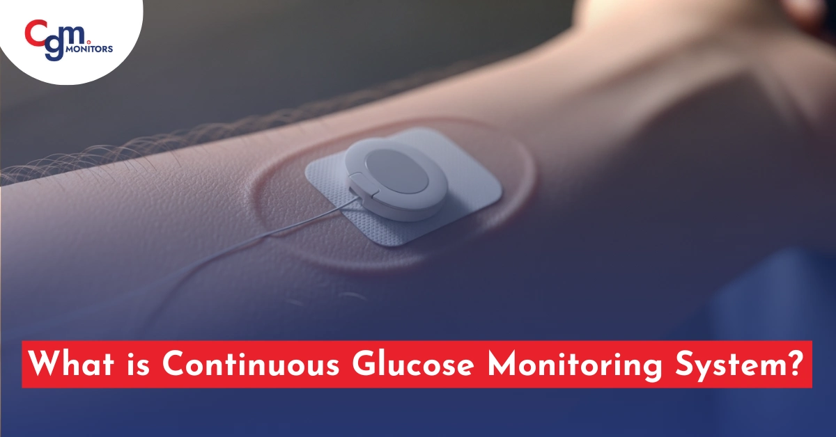 Continuous Glucose Monitoring System
