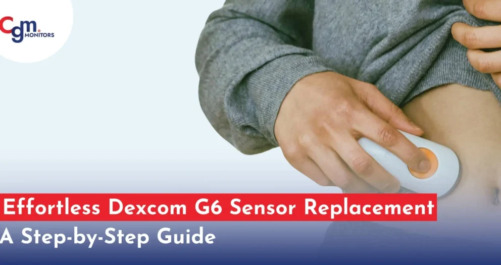 Dexcom G6 sensor replacement