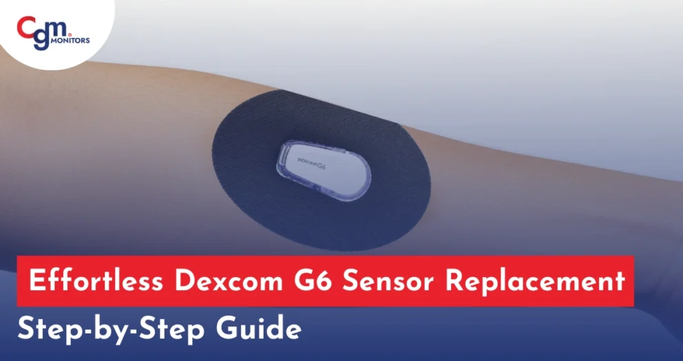 Dexcom G6 sensor replacement