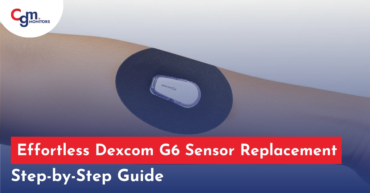 Dexcom G6 sensor replacement