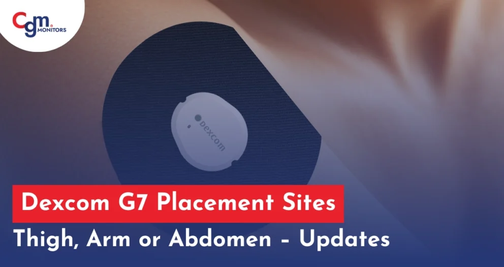 Dexcom G7 placement sites