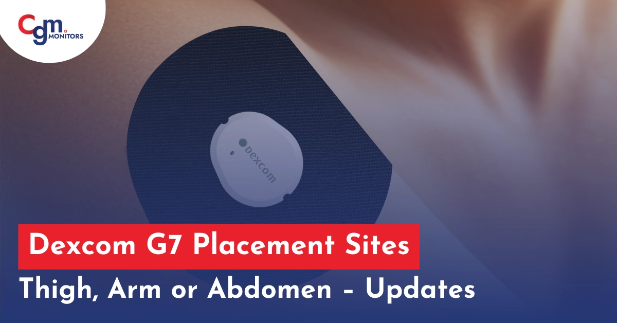 Dexcom G7 placement sites