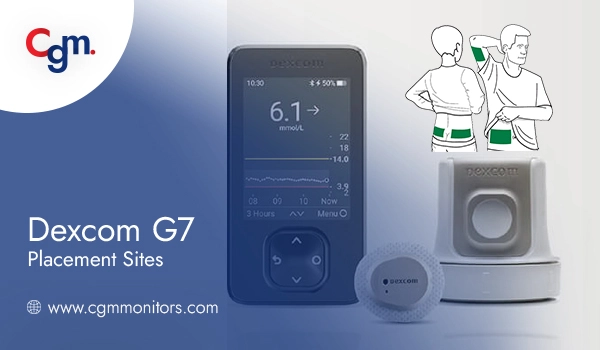 Dexcom G7 placement sites