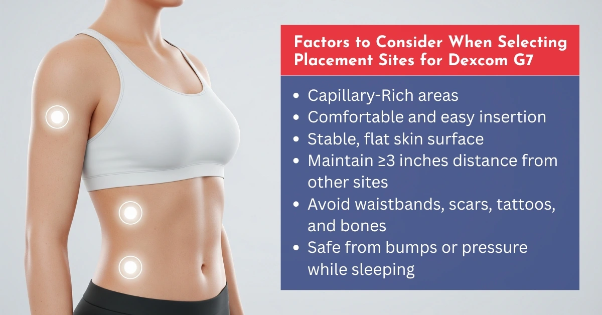 Factors to Consider When Selecting Placement Sites for Dexcom G7