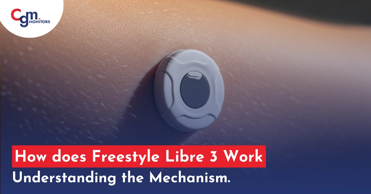 Freestyle Libre 3 Work