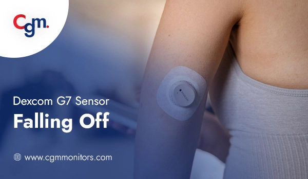 Dexcom G7 Falling Off