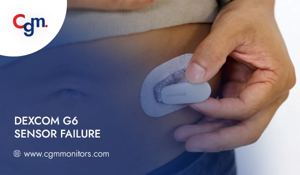 Dexcom G6 sensor failure