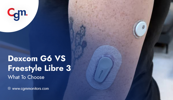Freestyle Libre 3 Vs Dexcom G6