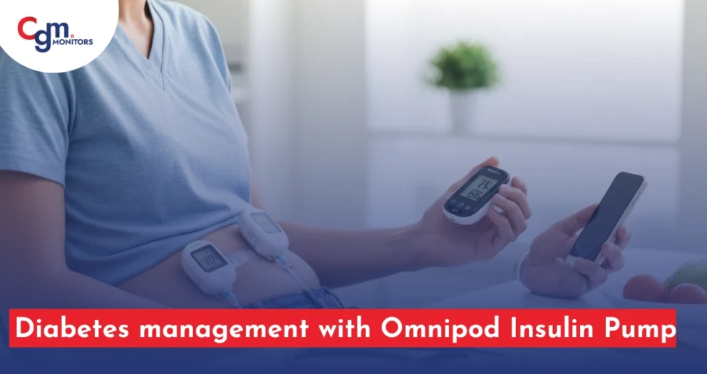 Omnipod Insulin Pump