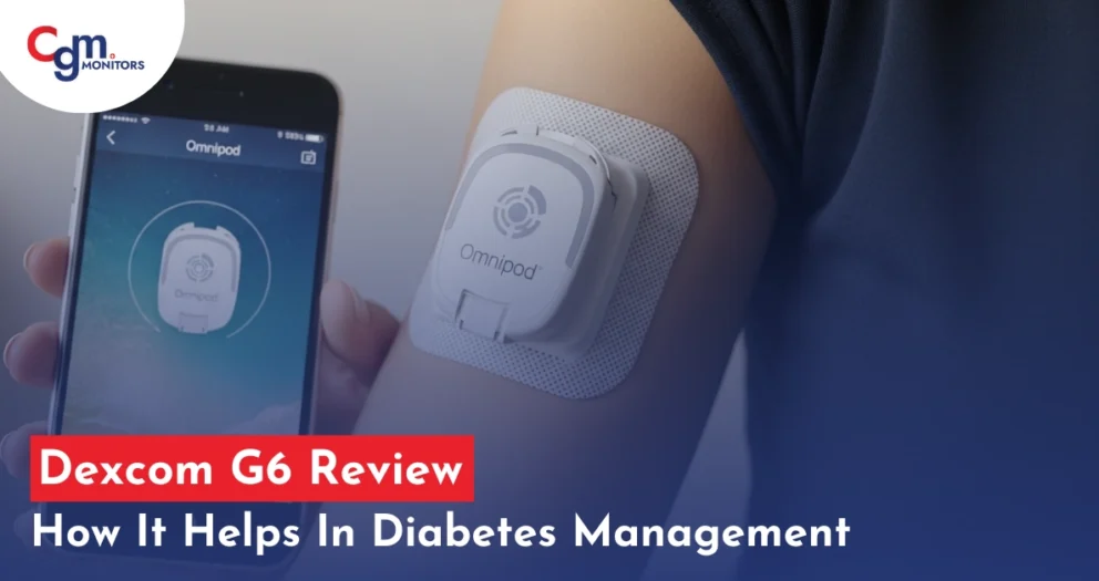 Omnipod and iPhone
