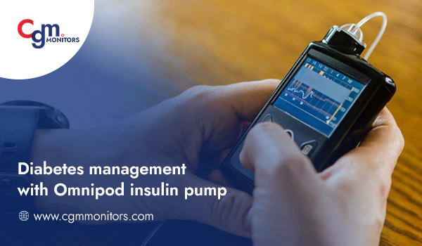 Omnipod insulin pump