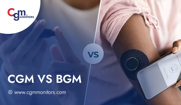 CGM VS BGM