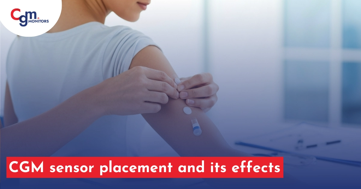 CGM sensor placement