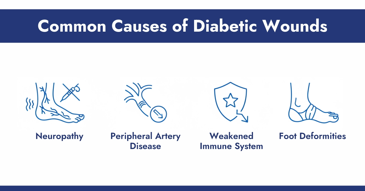 Common Causes of Diabetic Wounds