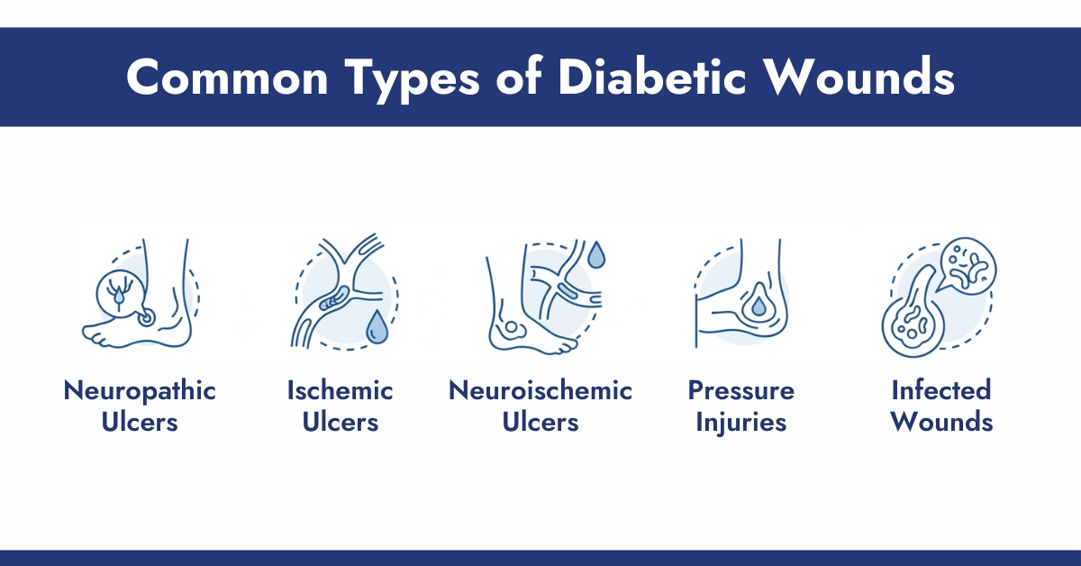 Common Types of Diabetic Wounds