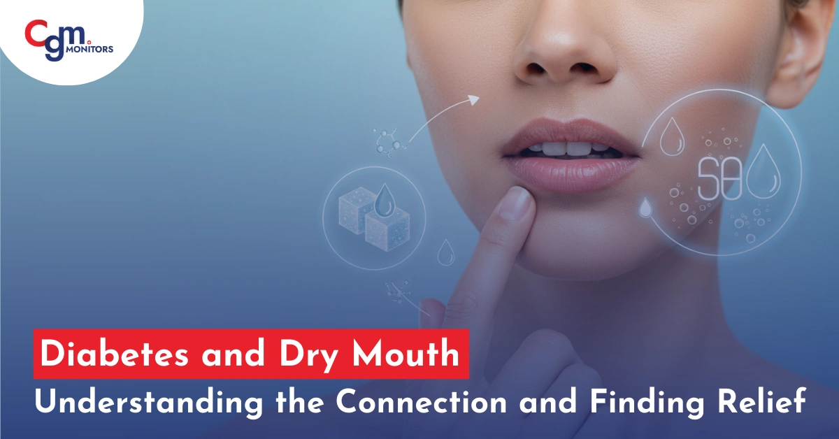 Diabetes and Dry Mouth