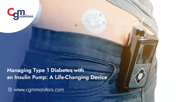 Managing Type 1 Diabetes with an Insulin Pump