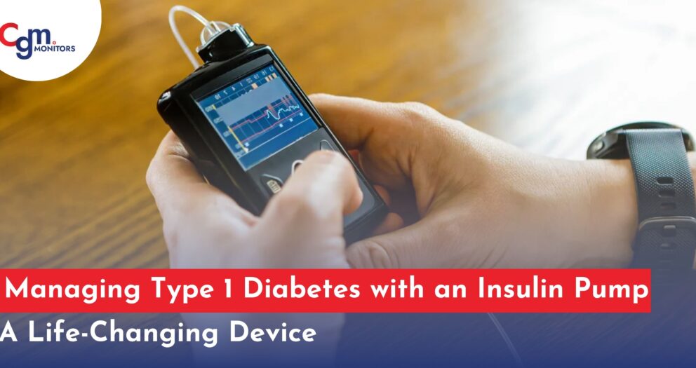 insulin pump for Type 1 diabetes