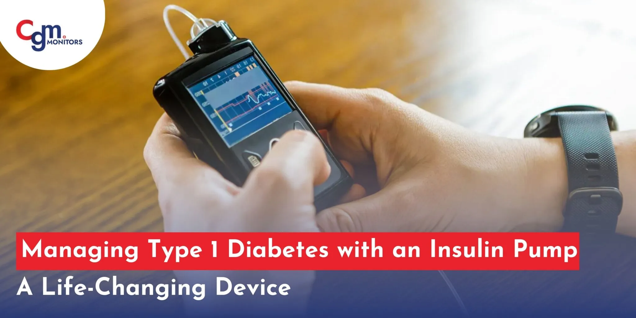 insulin pump for Type 1 diabetes