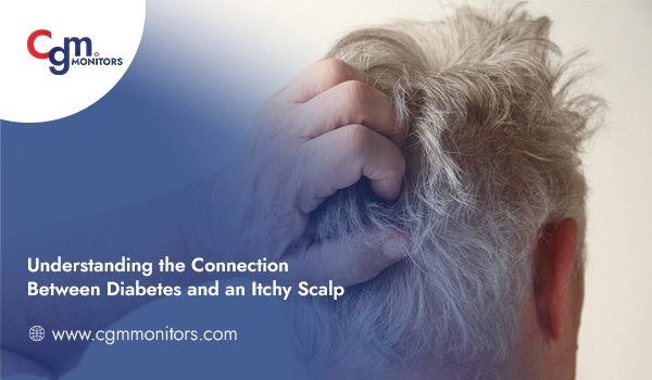 Diabetes and an itchy scalp