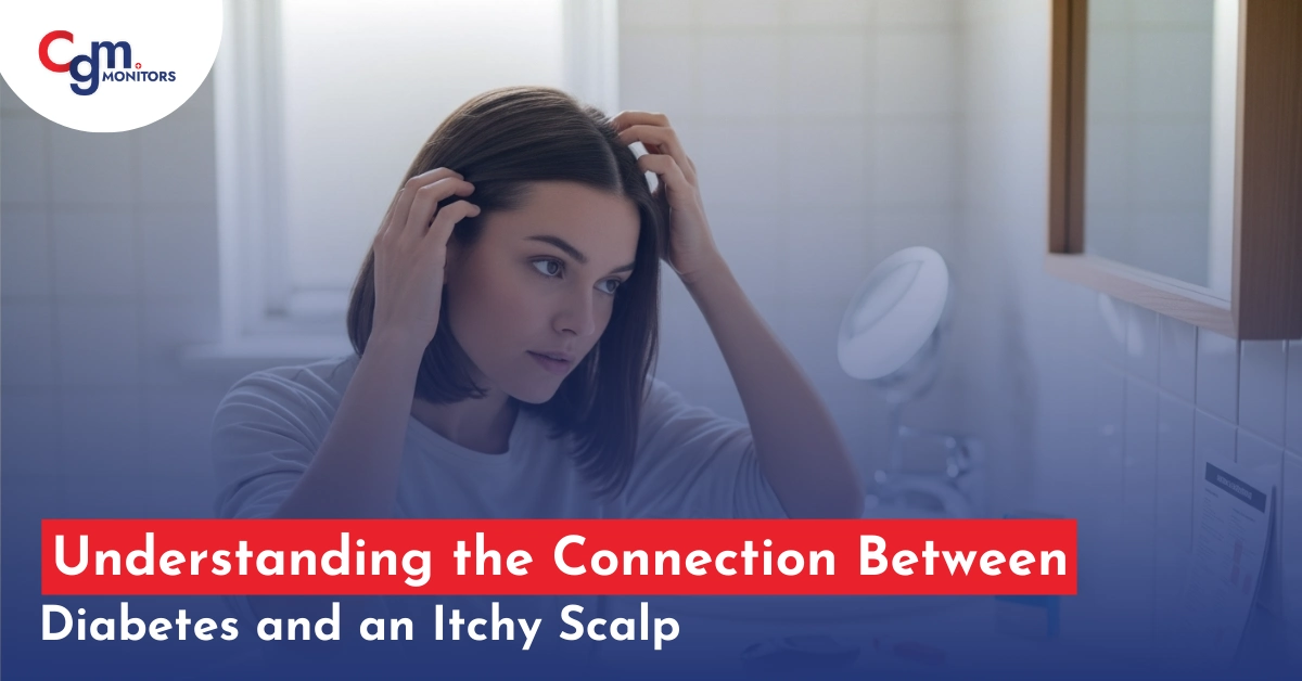 Diabetes and an itchy scalp