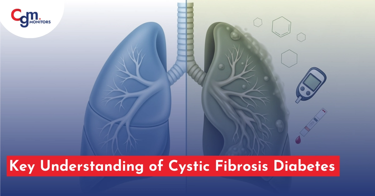Cystic Fibrosis Diabetes