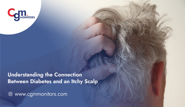 Understanding the Connection Between Diabetes and an Itchy Scalp