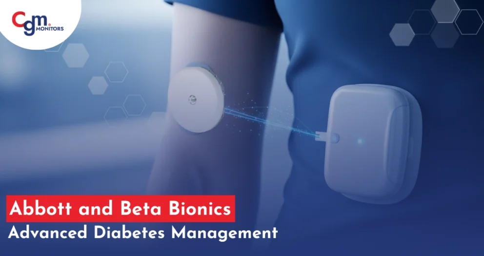 abbott and Beta Bionic