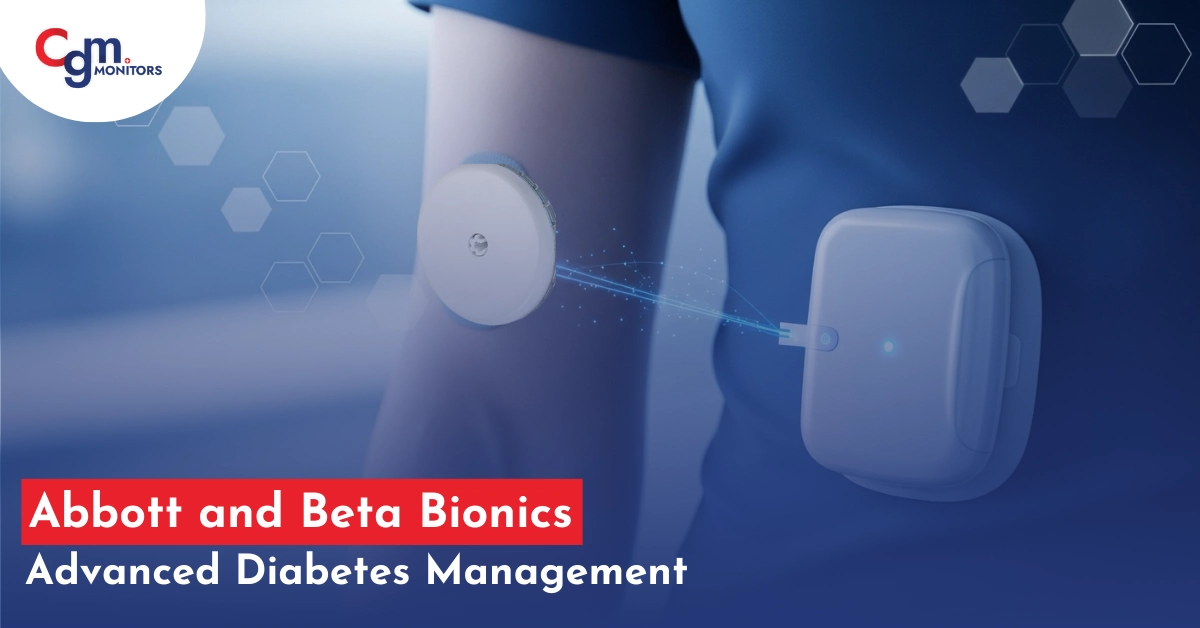 abbott and Beta Bionic