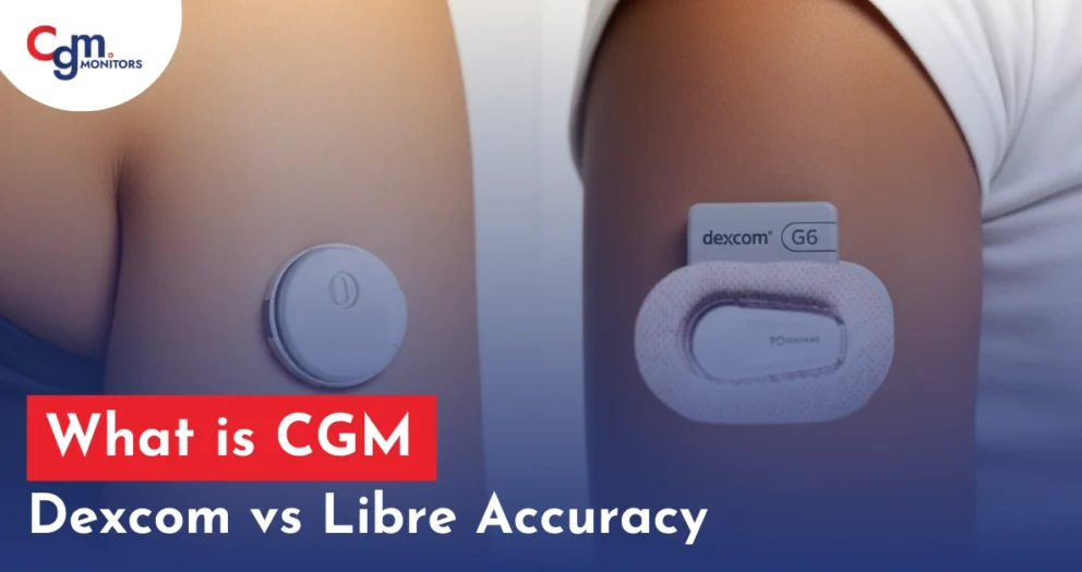 Dexcom vs Libre Accuracy