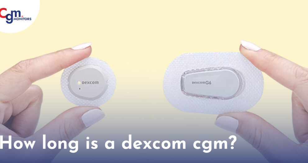 How Long is a Dexcom CGM For