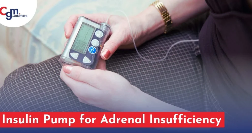 Insulin Pump for Adrenal Insufficiency