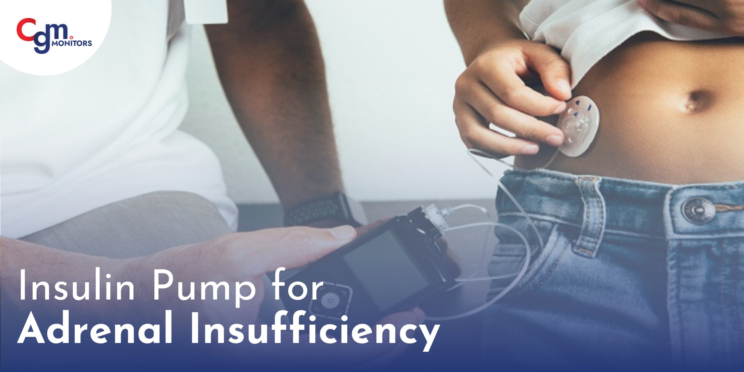 Insulin Pump for Adrenal Insufficiency