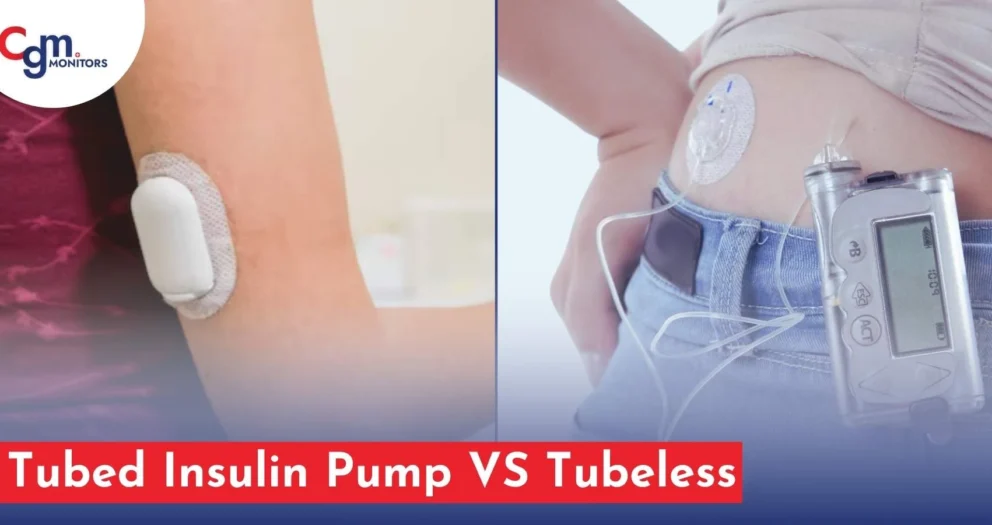 Tubed Insulin Pump VS Tubeless