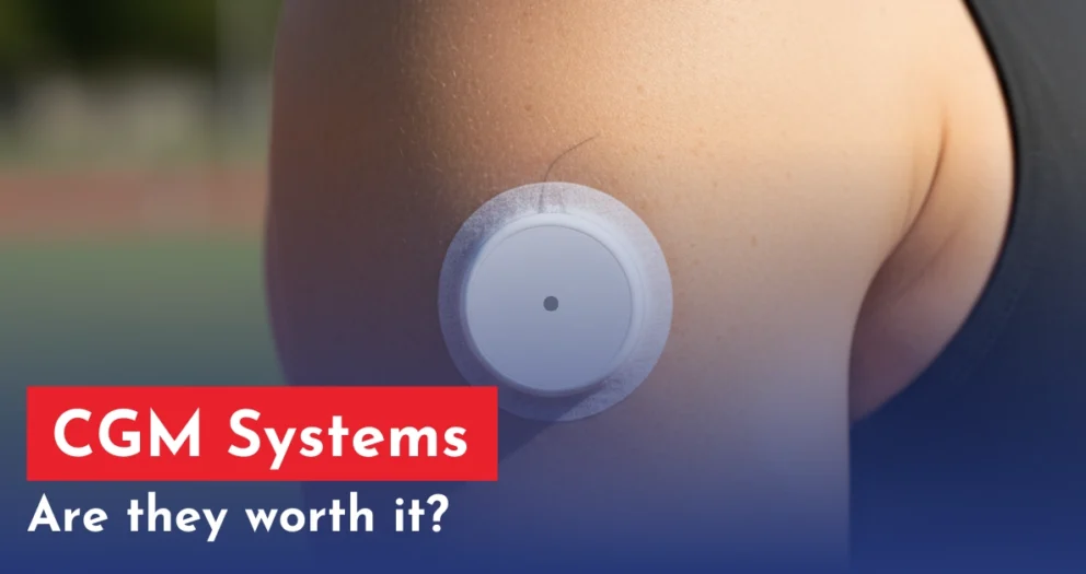 CGM Systems
