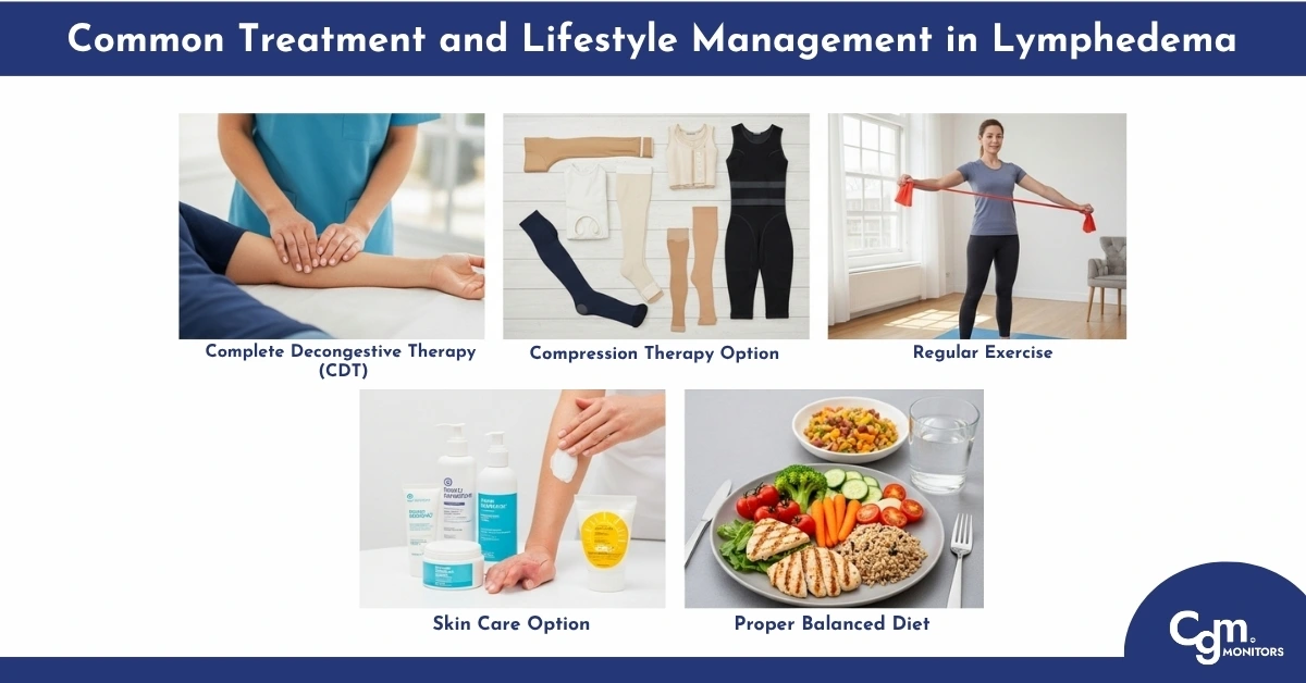 Common treatment and lifestyle management in lymphedema