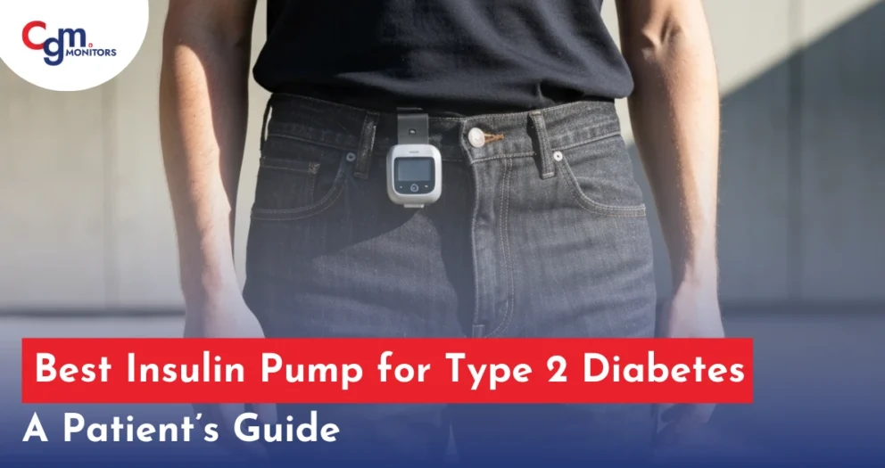 Best Insulin Pump for Type 2 Diabetes
