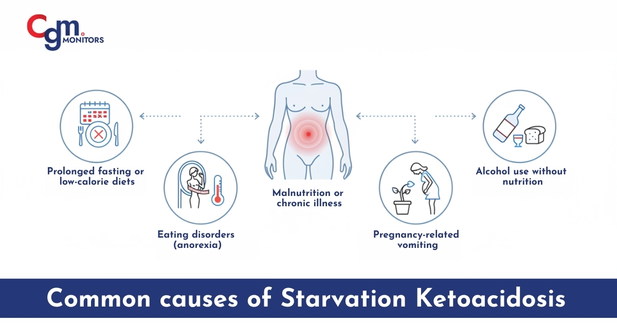 Common Causes of Starvation Ketoacidosis