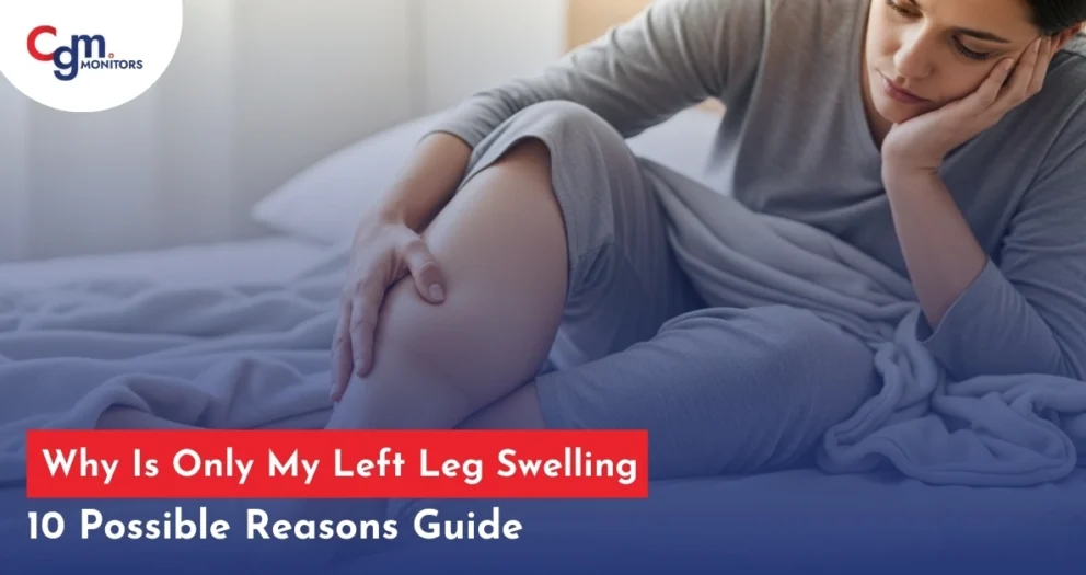Why Is Only My Left Leg Swelling