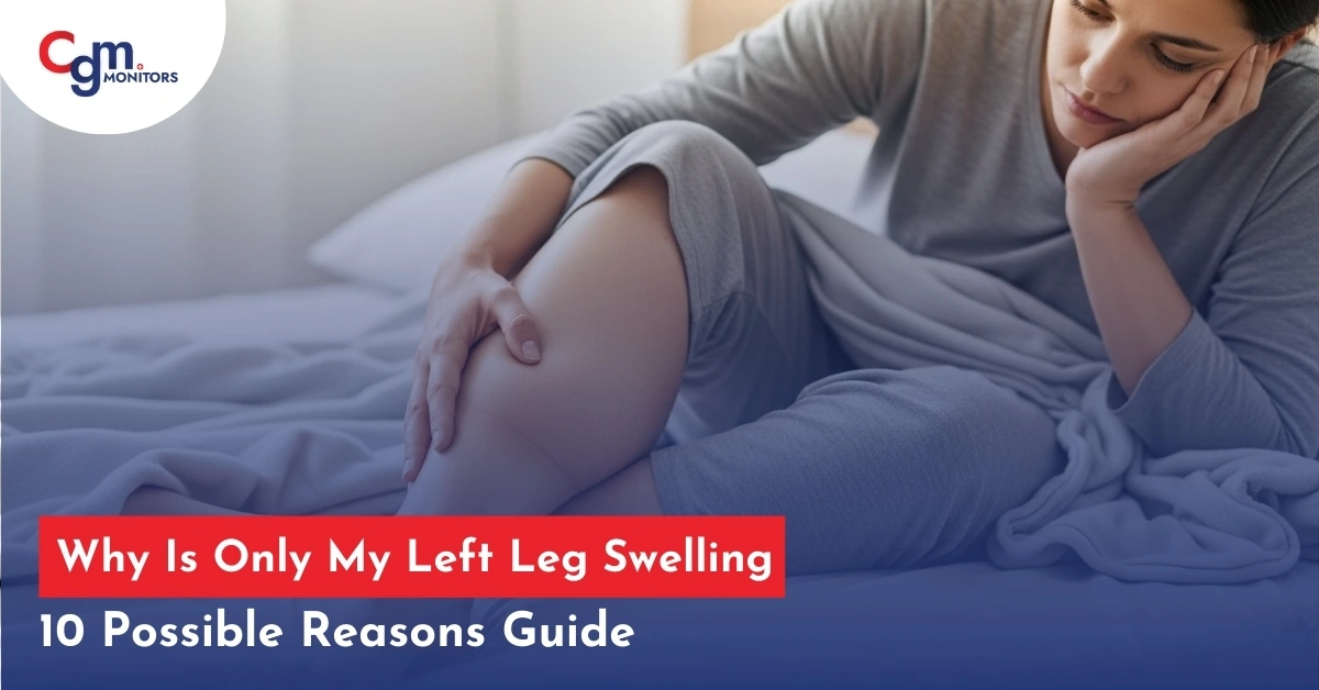 Why Is Only My Left Leg Swelling