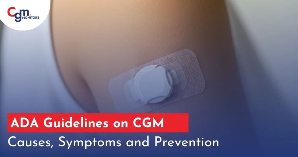 ADA Guidelines on CGM