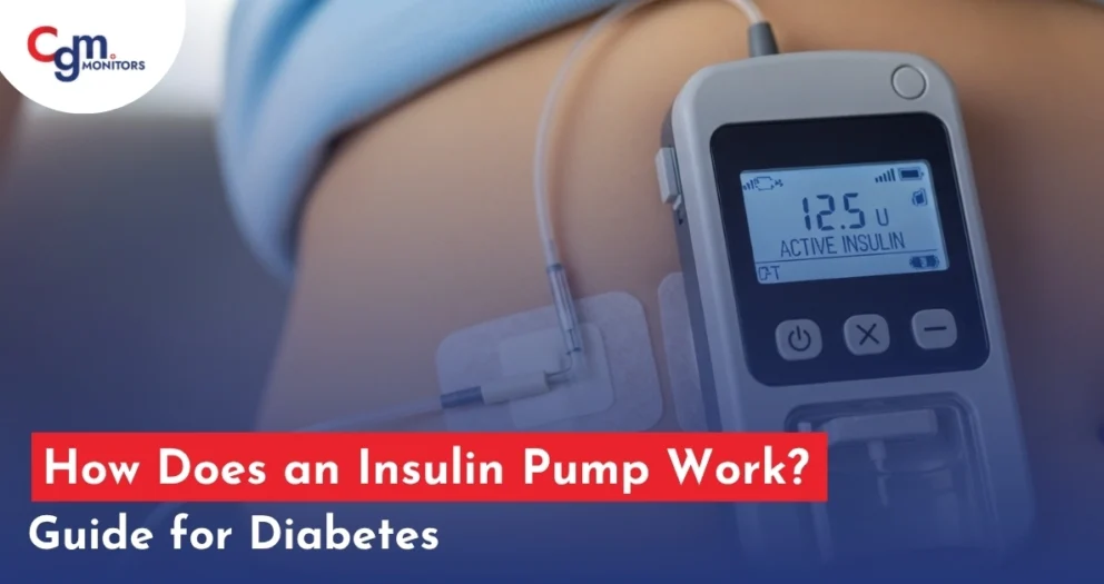 How Does an Insulin Pump Work