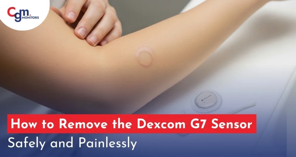 How to Remove Dexcom G7 Sensor