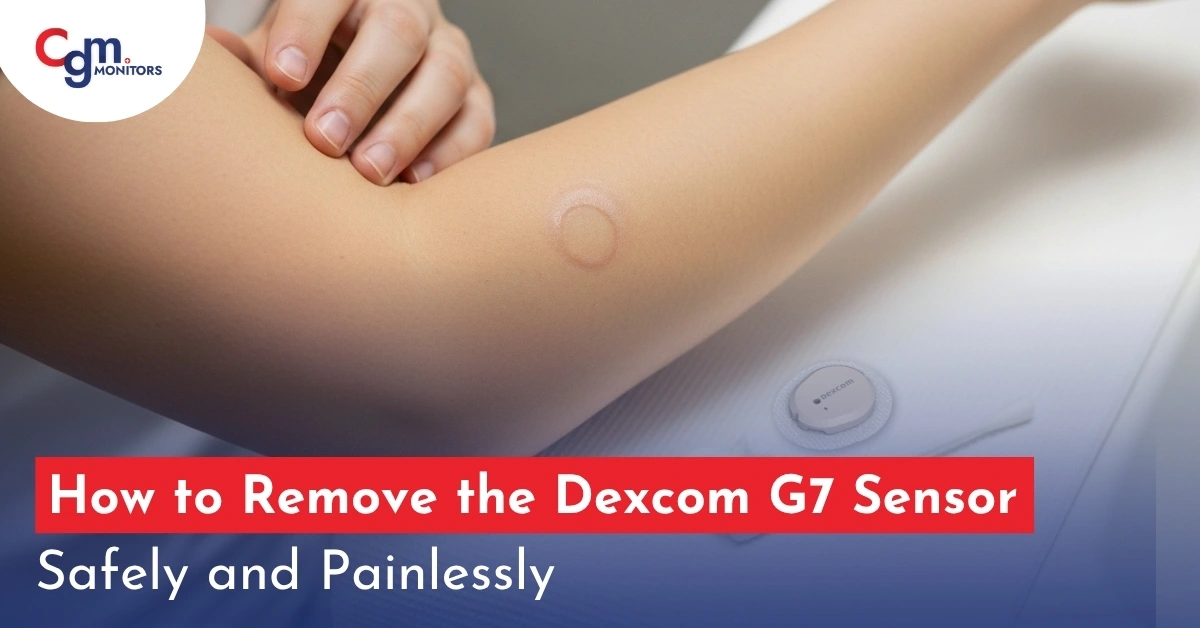 How to Remove Dexcom G7 Sensor