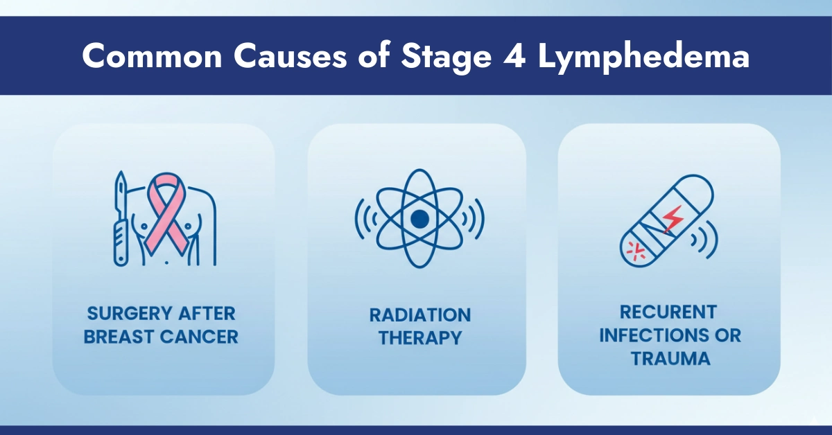 Common Causes of Stage 4 Lymphedema